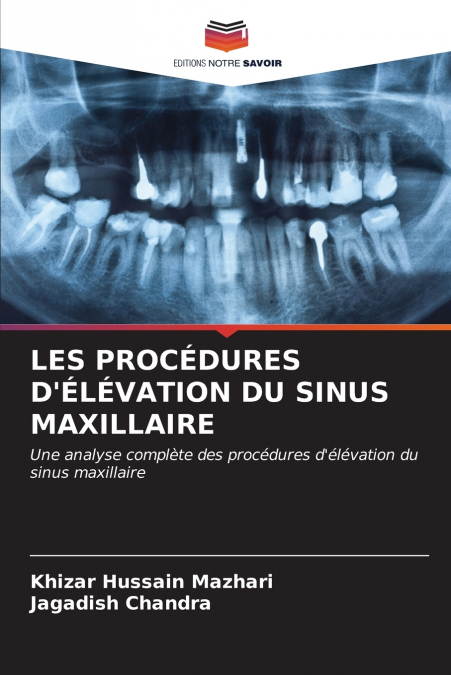 LES PROCÉDURES D’ÉLÉVATION DU SINUS MAXILLAIRE