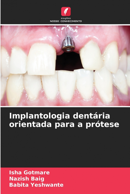 Implantologia dentária orientada para a prótese