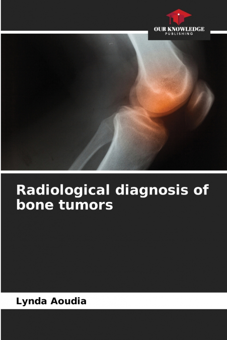 Radiological diagnosis of bone tumors