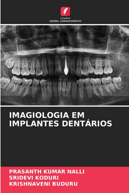 IMAGIOLOGIA EM IMPLANTES DENTÁRIOS