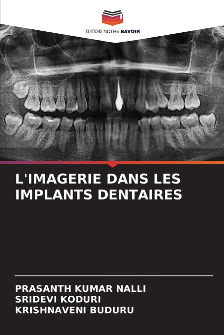 L’IMAGERIE DANS LES IMPLANTS DENTAIRES