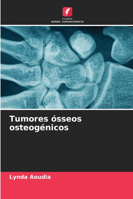 Tumores ósseos osteogénicos