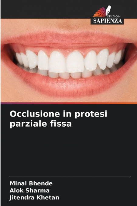 Occlusione in protesi parziale fissa