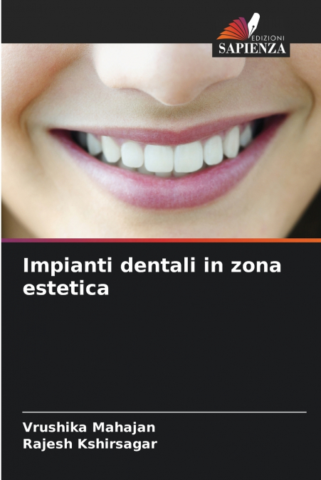 Impianti dentali in zona estetica