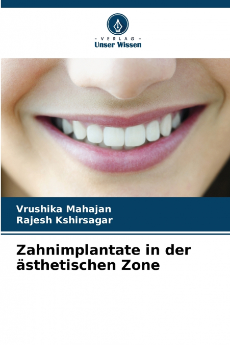 Zahnimplantate in der ästhetischen Zone