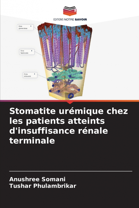 Stomatite urémique chez les patients atteints d’insuffisance rénale terminale