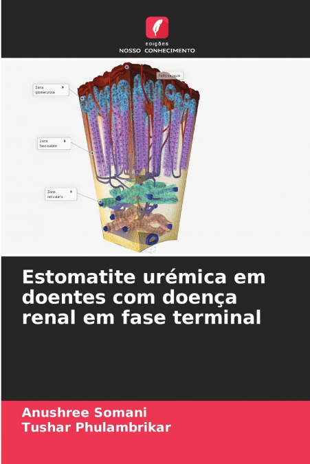 Estomatite urémica em doentes com doença renal em fase terminal
