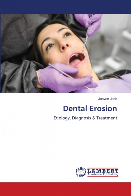 Dental Erosion