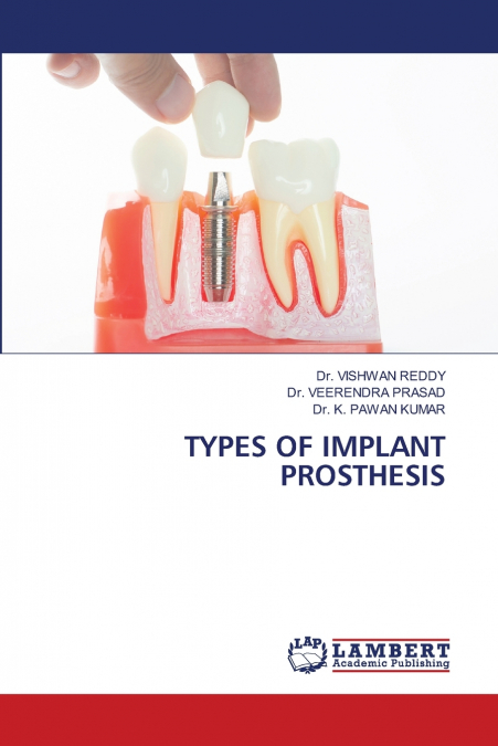 TYPES OF IMPLANT PROSTHESIS