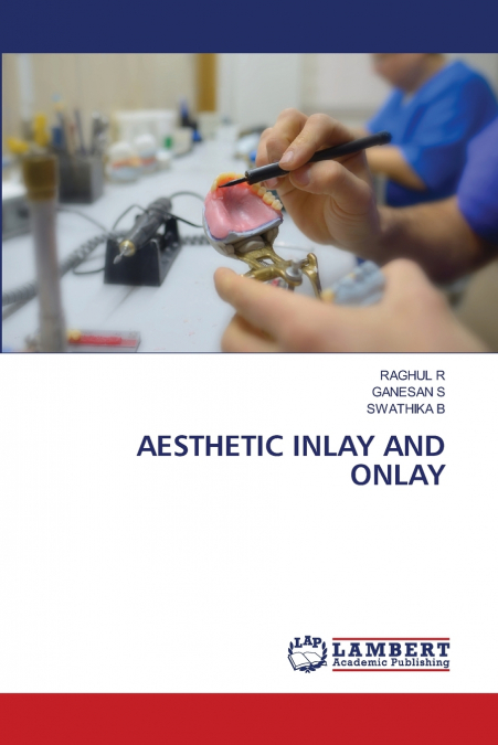 AESTHETIC INLAY AND ONLAY