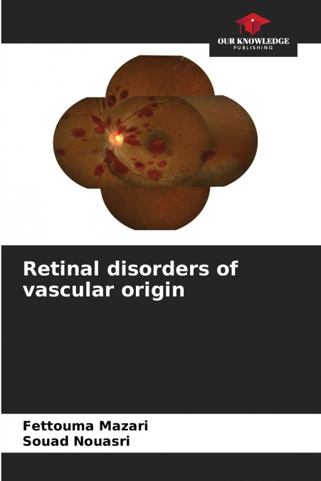 Retinal disorders of vascular origin