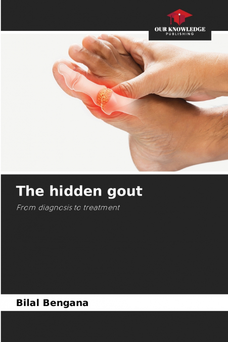 The hidden gout
