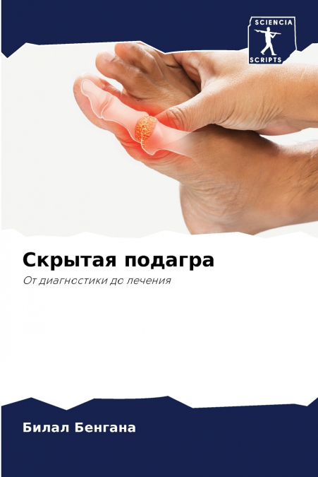 Скрытая подагра