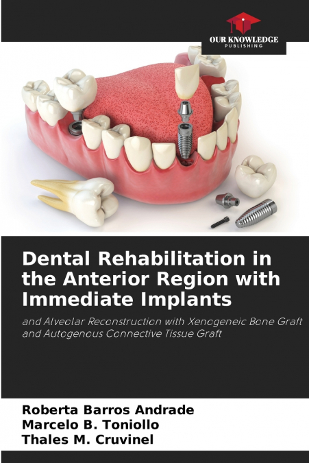 Dental Rehabilitation in the Anterior Region with Immediate Implants