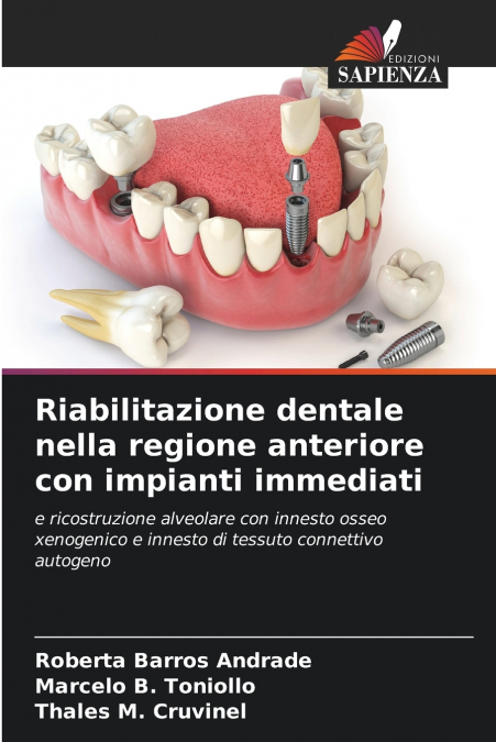 Riabilitazione dentale nella regione anteriore con impianti immediati
