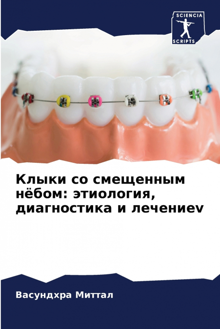 Клыки со смещенным нёбом