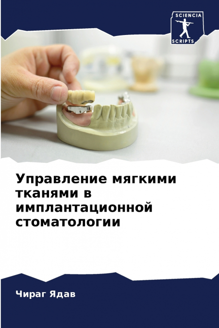 Управление мягкими тканями в имплантационной стоматологии