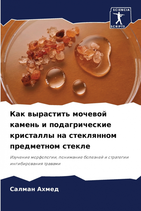 Как вырастить мочевой камень и подагрические кристаллы на стеклянном предметном стекле