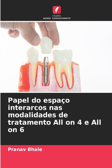 Papel do espaço interarcos nas modalidades de tratamento All on 4 e All on 6