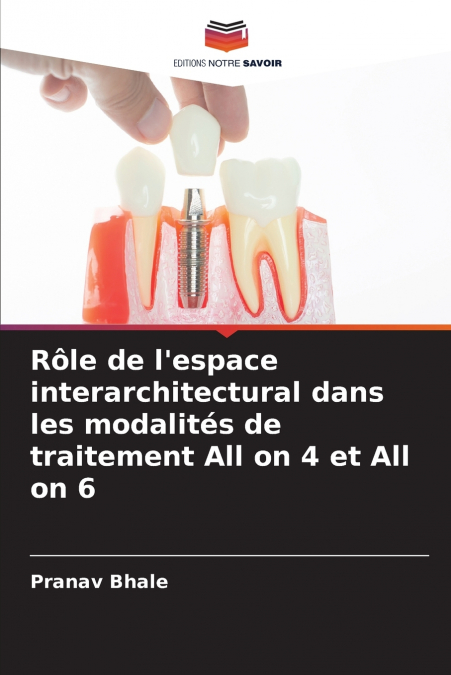 Rôle de l’espace interarchitectural dans les modalités de traitement All on 4 et All on 6