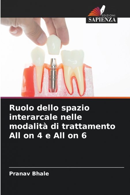 Ruolo dello spazio interarcale nelle modalità di trattamento All on 4 e All on 6