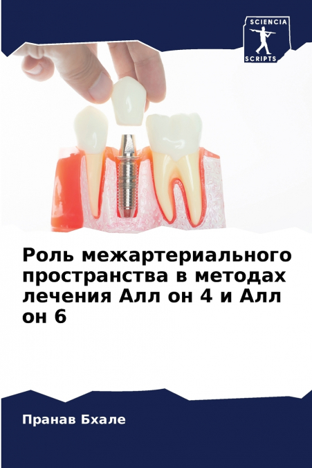 Роль межартериального пространства в методах лечения Алл он 4 и Алл он 6