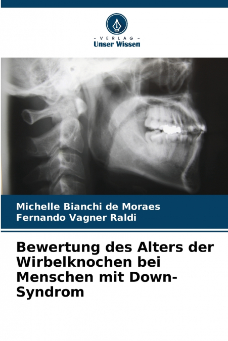 Bewertung des Alters der Wirbelknochen bei Menschen mit Down-Syndrom