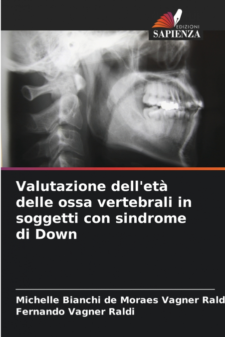 Valutazione dell’età delle ossa vertebrali in soggetti con sindrome di Down