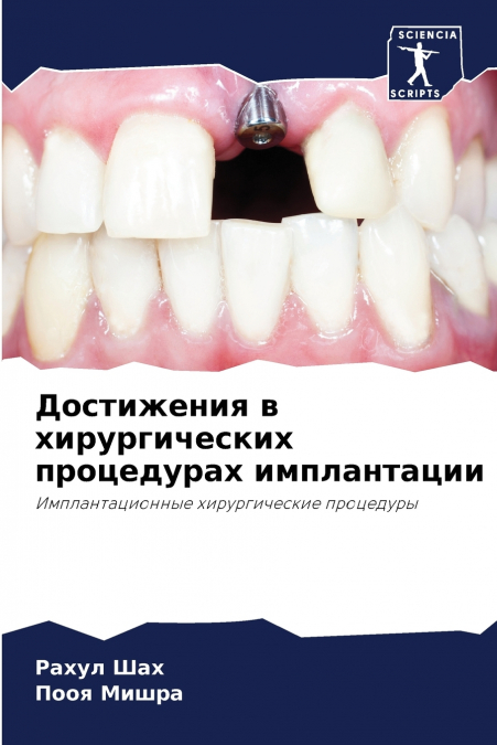 Достижения в хирургических процедурах имплантации