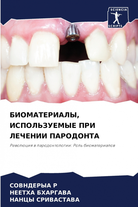 БИОМАТЕРИАЛЫ, ИСПОЛЬЗУЕМЫЕ ПРИ ЛЕЧЕНИИ ПАРОДОНТА