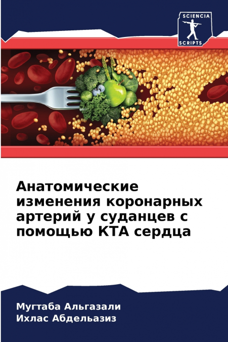 Анатомические изменения коронарных артерий у суданцев с помощью КТА сердца