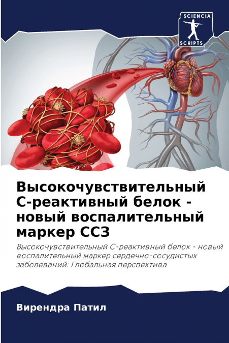 Высокочувствительный С-реактивный белок - новый воспалительный маркер ССЗ