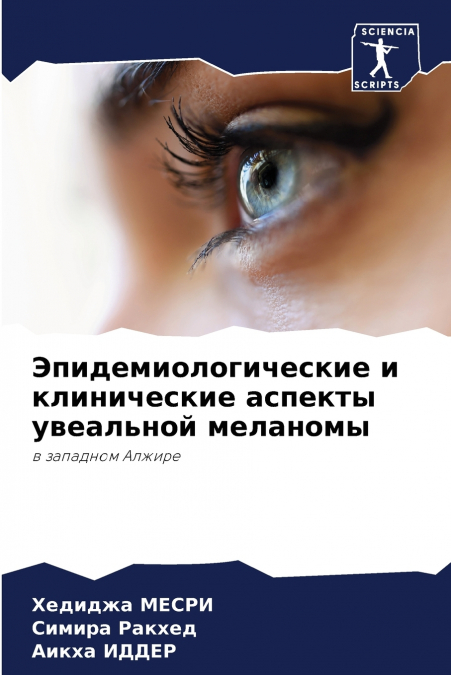 Эпидемиологические и клинические аспекты увеальной меланомы