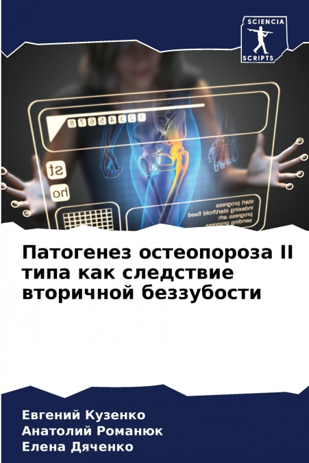Патогенез остеопороза II типа как следствие вторичной беззубости