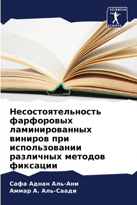 Несостоятельность фарфоровых ламинированных виниров при использовании различных методов фиксации