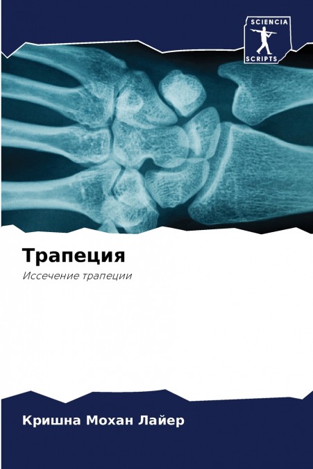 Трапеция