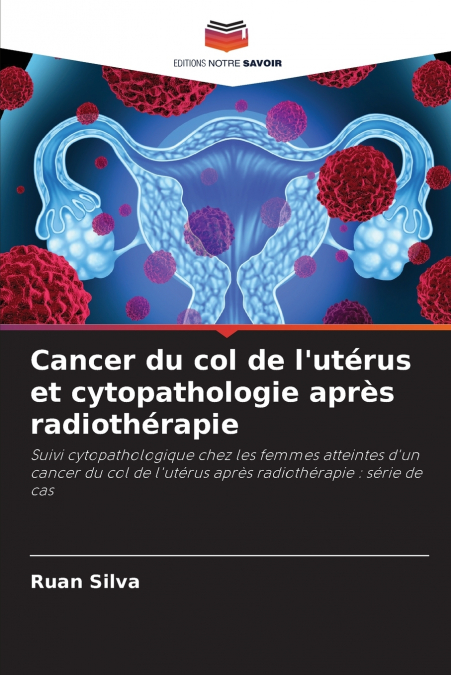 Cancer du col de l’utérus et cytopathologie après radiothérapie