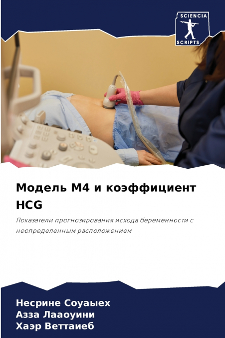 Модель M4 и коэффициент HCG