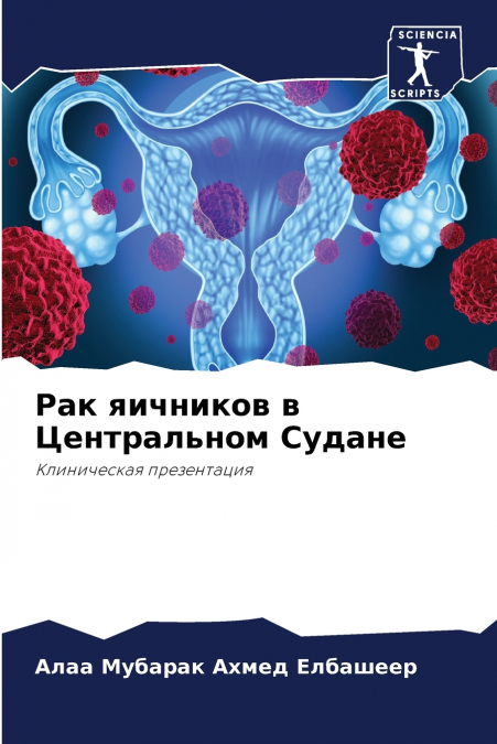 Рак яичников в Центральном Судане