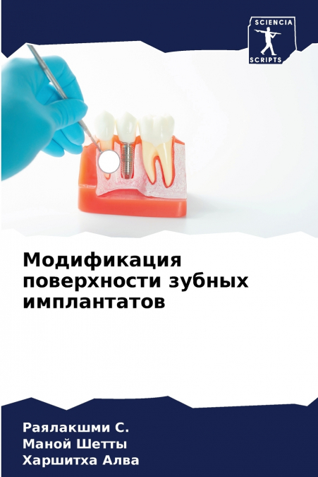 Модификация поверхности зубных имплантатов