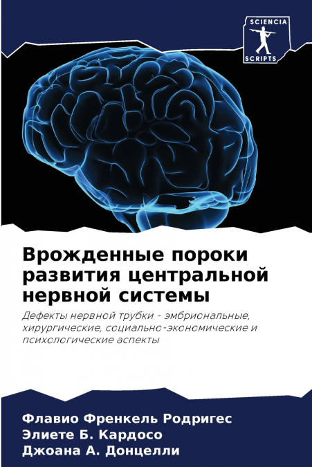 Врожденные пороки развития центральной нервной системы
