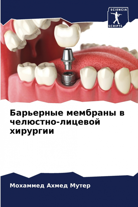 Барьерные мембраны в челюстно-лицевой хирургии