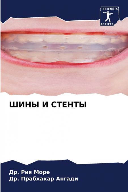 ШИНЫ И СТЕНТЫ