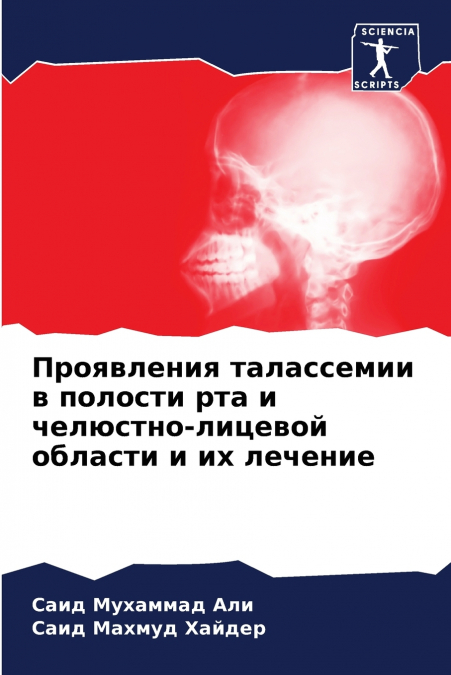 Проявления талассемии в полости рта и челюстно-лицевой области и их лечение