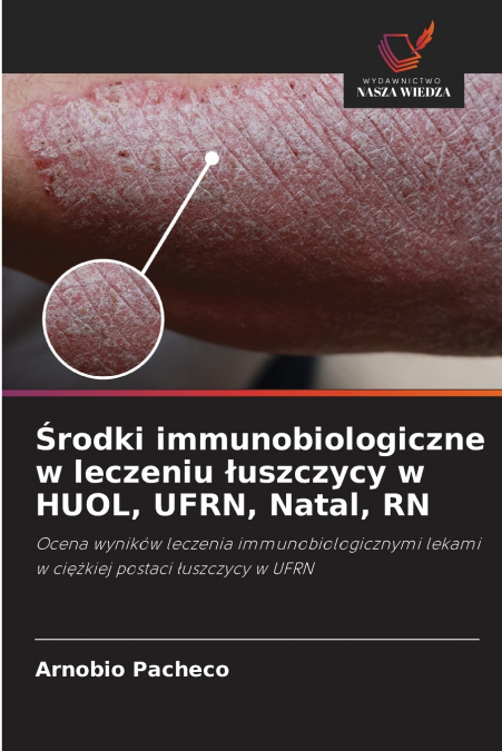 Środki immunobiologiczne w leczeniu łuszczycy w HUOL, UFRN, Natal, RN