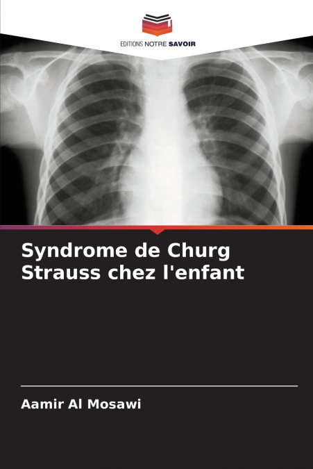 Syndrome de Churg Strauss chez l’enfant