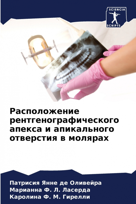 Расположение рентгенографического апекса и апикального отверстия в молярах
