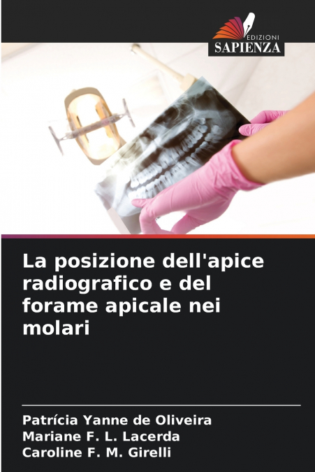 La posizione dell’apice radiografico e del forame apicale nei molari