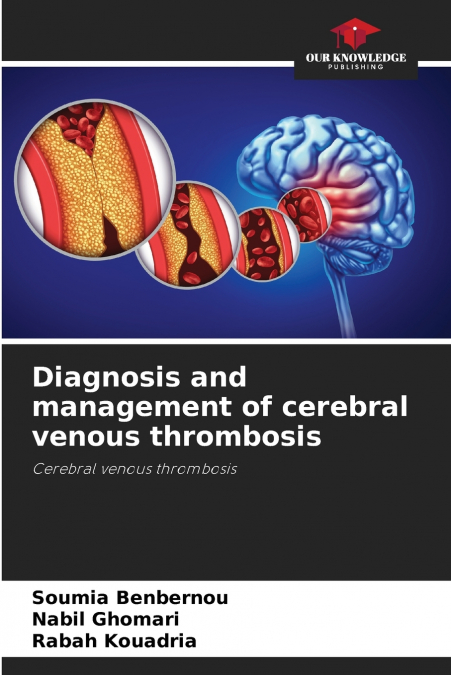 Diagnosis and management of cerebral venous thrombosis