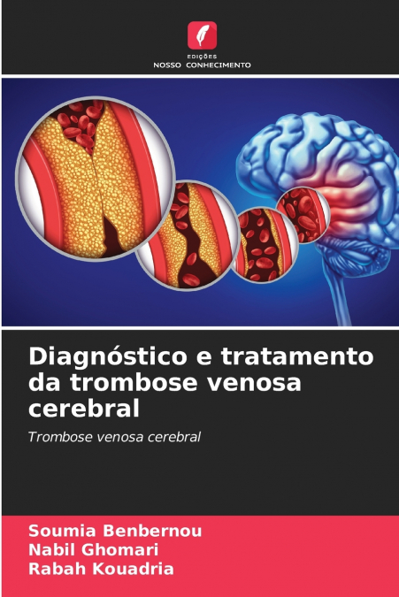 Diagnóstico e tratamento da trombose venosa cerebral
